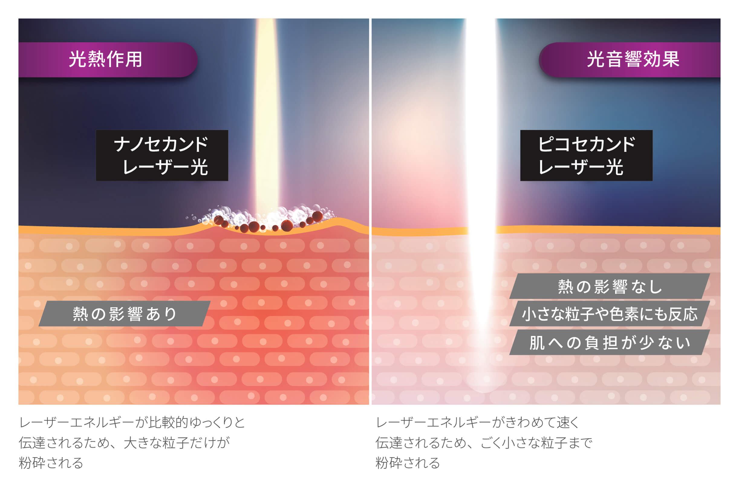 PicoWay®ピコセカンドレーザーによる光音響効果と従来のナノ秒レーザーによる光熱作用の比較イメージ