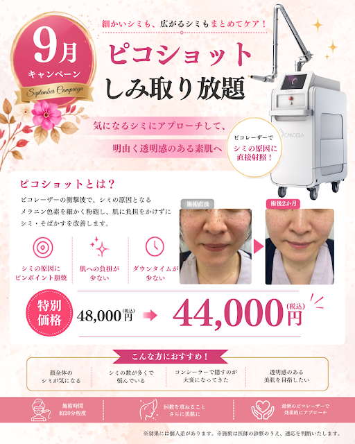 2026年9月キャンペーン ピコショットしみ取り放題 特別価格44,000円（税込）