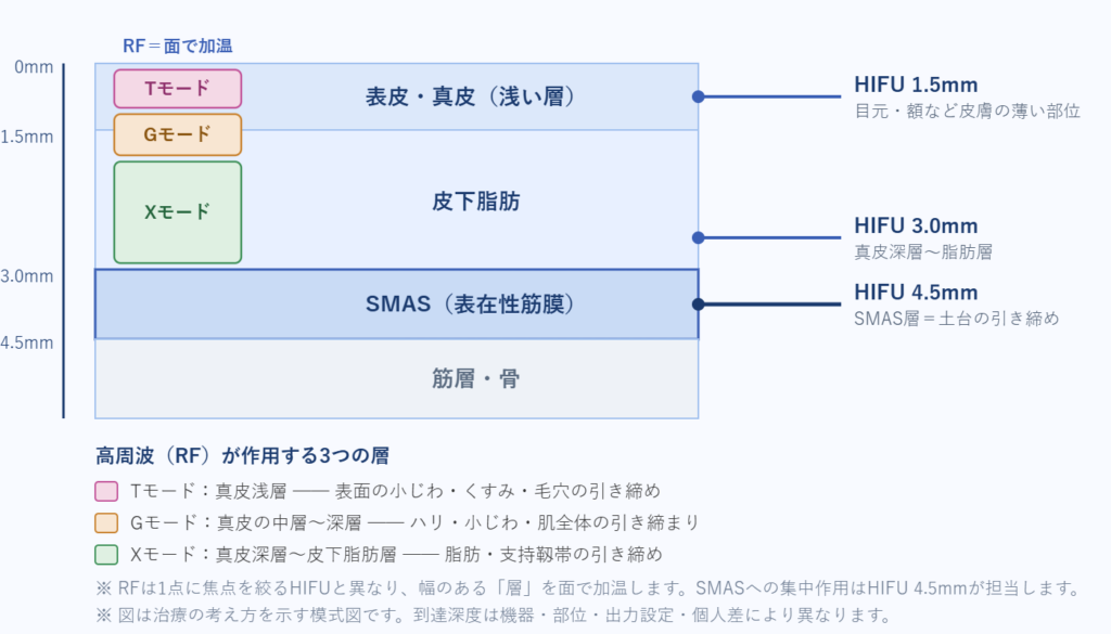 HIFUの1.5・3.0・4.5mmと、高周波RFのTモード(真皮浅層)・Gモード(真皮中〜深層)・Xモード(真皮深層〜皮下脂肪層)が作用する皮膚の層を示した図解|五良会クリニック白金高輪2F
